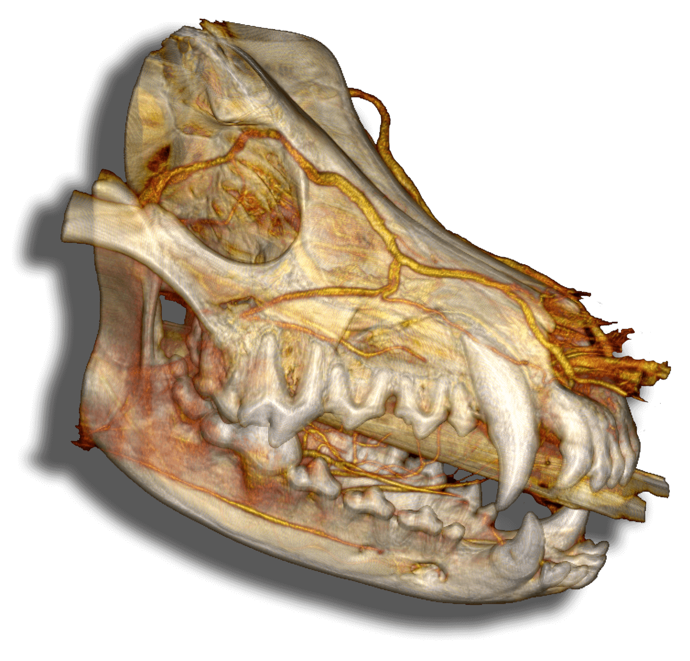 CT Scans