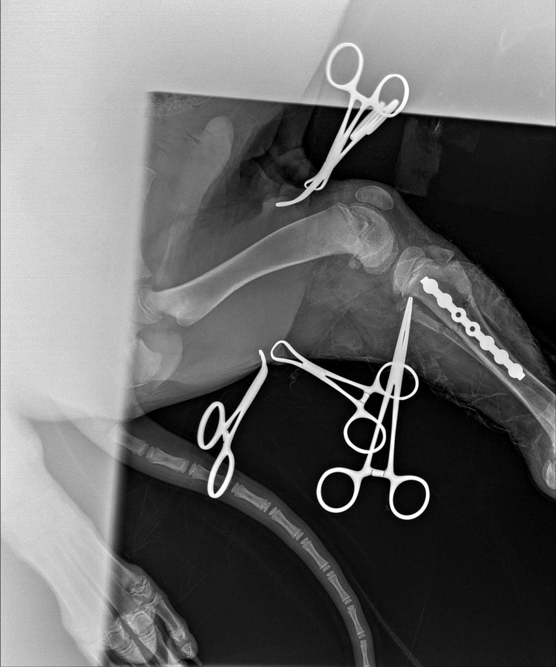 Orthopedics